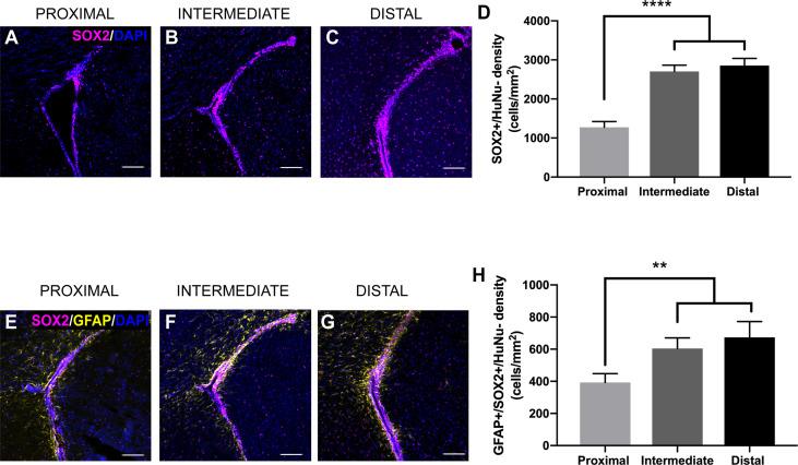 https://cdn.ncbi.nlm.nih.gov/pmc/blobs/186e/8277421/0336dd6054b7/fonc-11-650316-g004.jpg
