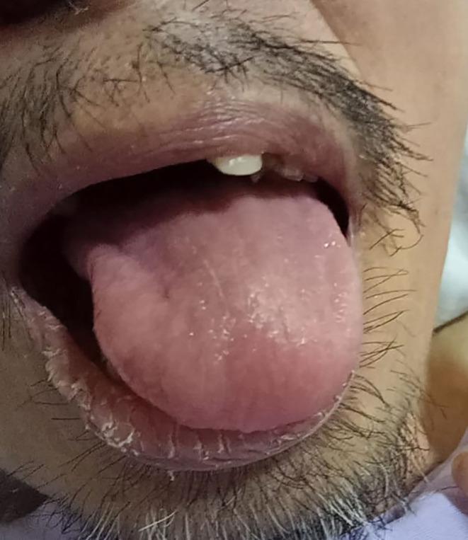 https://cdn.ncbi.nlm.nih.gov/pmc/blobs/1872/10203351/5238b64c3b94/IMCRJ-16-303-g0004.jpg