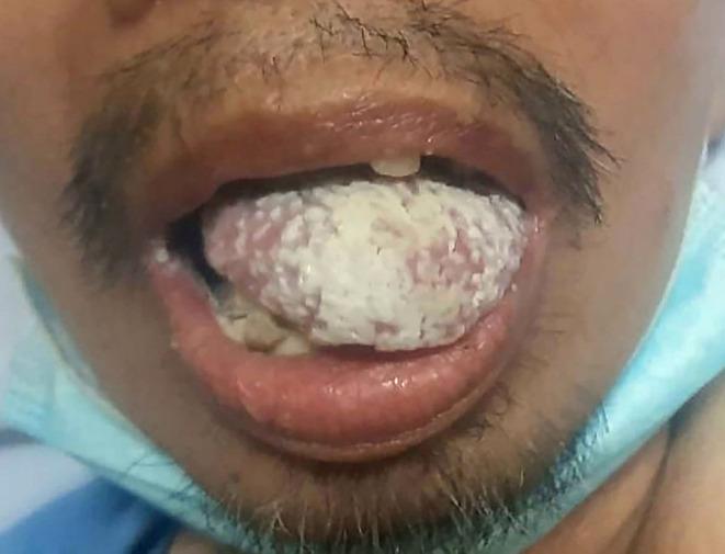 https://cdn.ncbi.nlm.nih.gov/pmc/blobs/1872/10203351/cbb8c915d5c2/IMCRJ-16-303-g0001.jpg