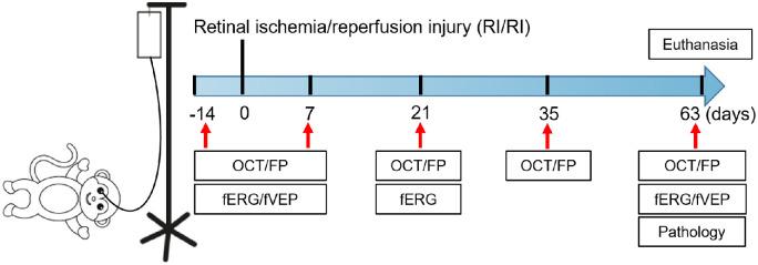 https://cdn.ncbi.nlm.nih.gov/pmc/blobs/1873/10289273/857df03e61b7/tvst-12-6-14-f001.jpg