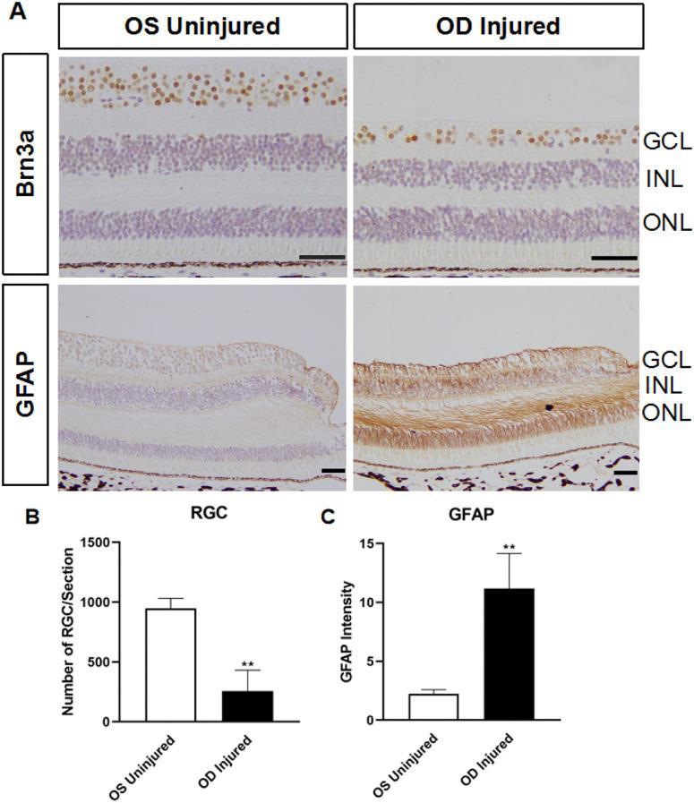 https://cdn.ncbi.nlm.nih.gov/pmc/blobs/1873/10289273/b571f41c803e/tvst-12-6-14-f005.jpg