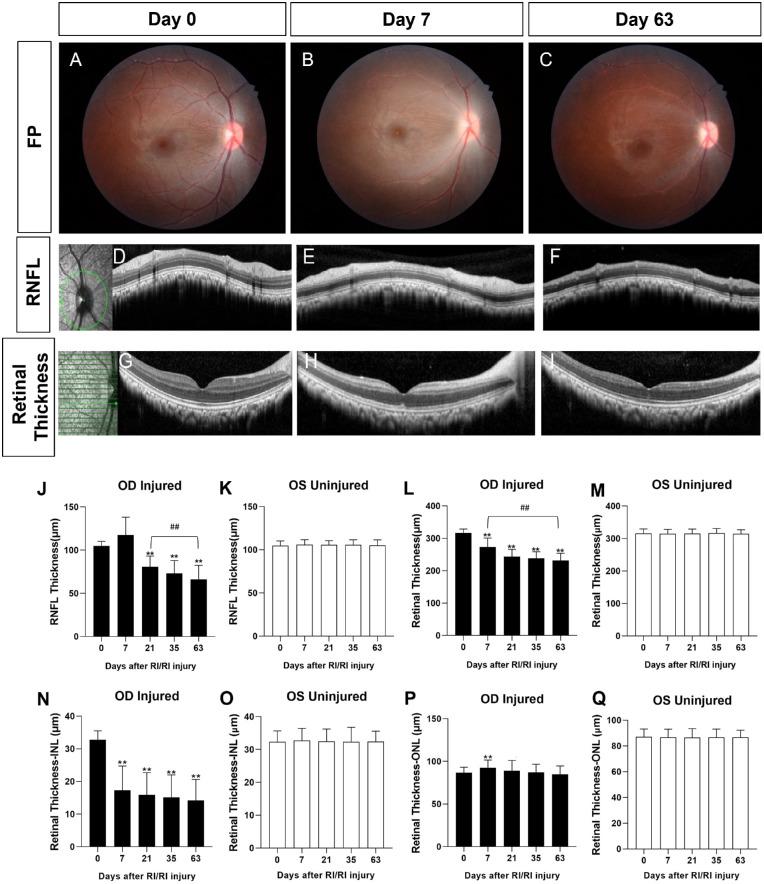 https://cdn.ncbi.nlm.nih.gov/pmc/blobs/1873/10289273/df36d15687c7/tvst-12-6-14-f003.jpg