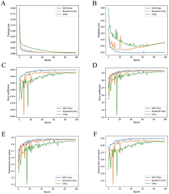 https://cdn.ncbi.nlm.nih.gov/pmc/blobs/1874/10565704/0346ba11d319/iovs-64-13-7-f005.jpg