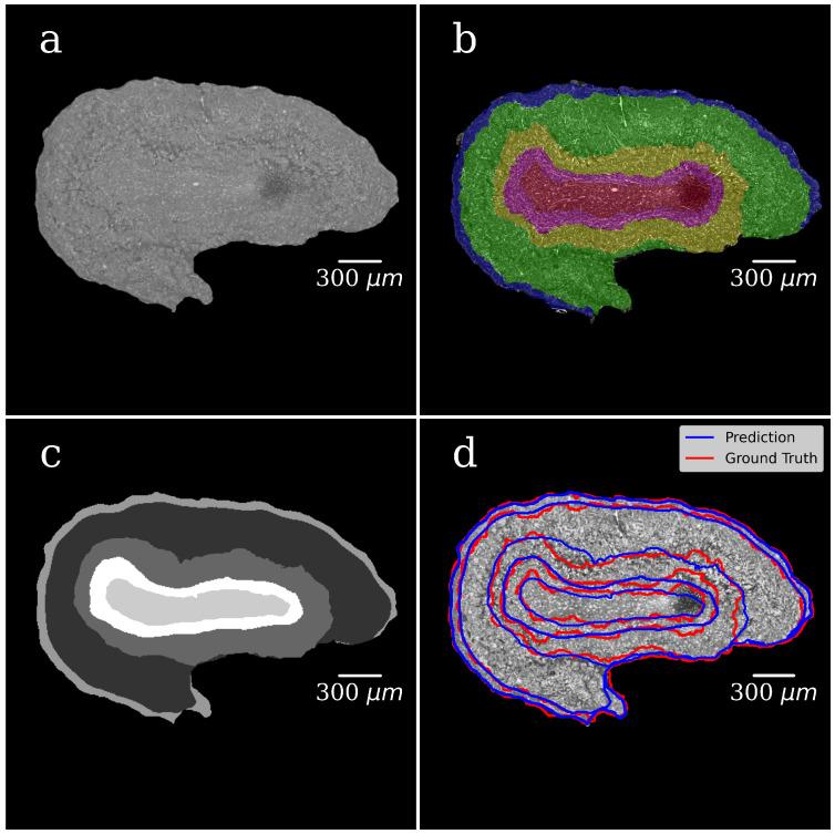 https://cdn.ncbi.nlm.nih.gov/pmc/blobs/1877/9331385/8d5c09bd7ac7/tomography-08-00156-g005.jpg
