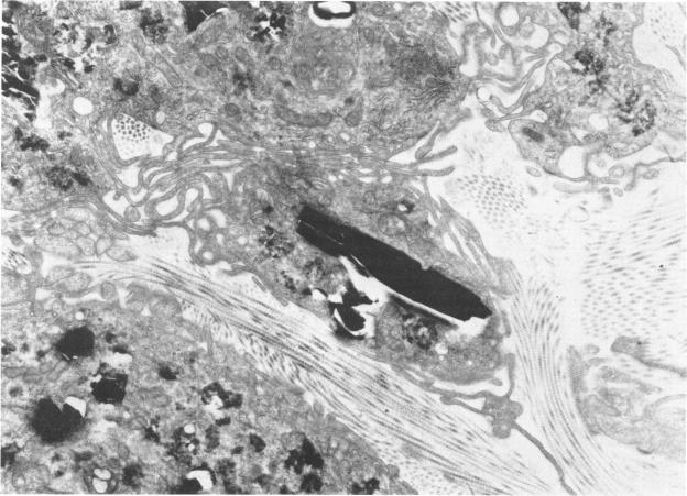https://cdn.ncbi.nlm.nih.gov/pmc/blobs/1879/1475231/eae1a7214a30/envhper00491-0062-a.jpg