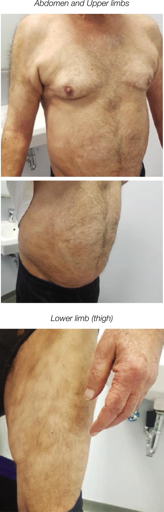 https://cdn.ncbi.nlm.nih.gov/pmc/blobs/187b/10201092/a602a9c1528d/MJR-34-1-78-g002.jpg