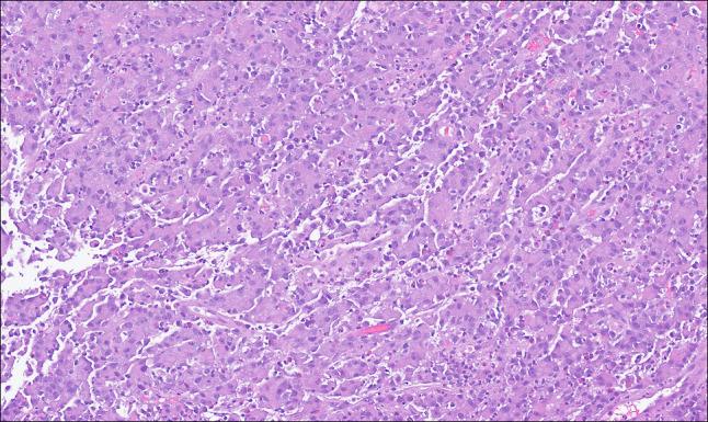https://cdn.ncbi.nlm.nih.gov/pmc/blobs/1880/12273645/3a8c3e7fe7d1/ac9-12-e01775-g004.jpg