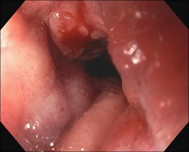https://cdn.ncbi.nlm.nih.gov/pmc/blobs/1880/12273645/3d748408e311/ac9-12-e01775-g002.jpg