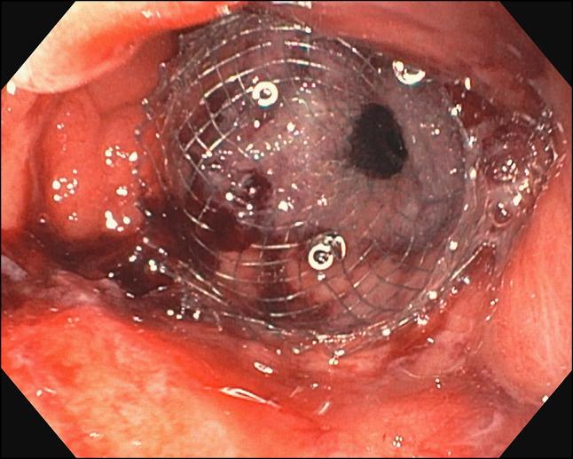 https://cdn.ncbi.nlm.nih.gov/pmc/blobs/1880/12273645/d8dae85b766f/ac9-12-e01775-g003.jpg