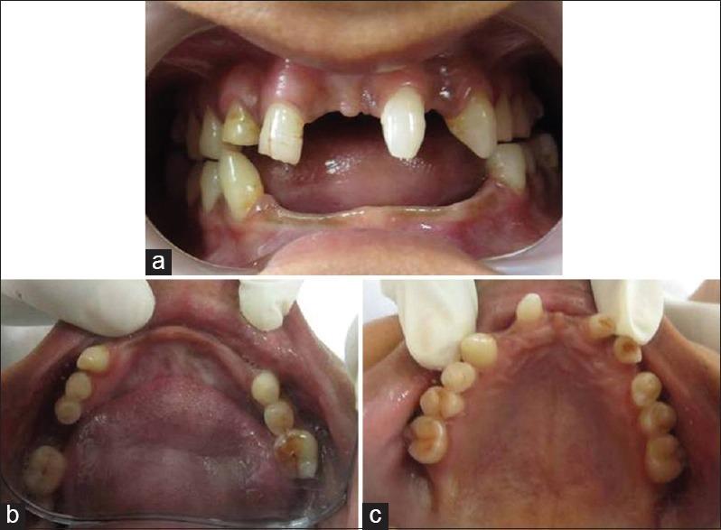 https://cdn.ncbi.nlm.nih.gov/pmc/blobs/1880/4632232/53d8a3e83a11/CCD-6-258-g001.jpg