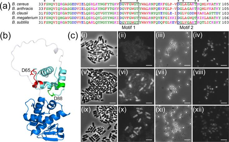 https://cdn.ncbi.nlm.nih.gov/pmc/blobs/1881/12331253/75d802a6cb82/mic-171-01591-g004.jpg