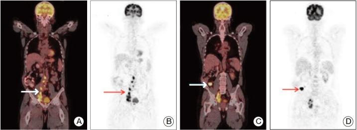 https://cdn.ncbi.nlm.nih.gov/pmc/blobs/1885/4614216/b822709a7637/crt-2014-157f5.jpg