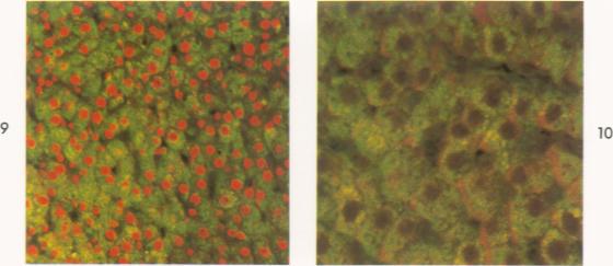 https://cdn.ncbi.nlm.nih.gov/pmc/blobs/1886/1910851/36cde35472ab/amjpathol00476-0083-c.jpg