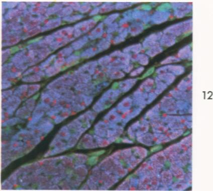 https://cdn.ncbi.nlm.nih.gov/pmc/blobs/1886/1910851/6f11b80d7047/amjpathol00476-0083-e.jpg