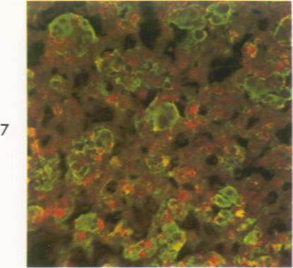 https://cdn.ncbi.nlm.nih.gov/pmc/blobs/1886/1910851/d8efa57d1a03/amjpathol00476-0083-a.jpg