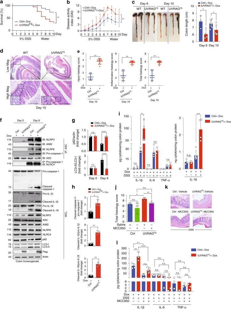 https://cdn.ncbi.nlm.nih.gov/pmc/blobs/1889/6908726/2daca40a7696/41467_2019_13475_Fig4_HTML.jpg