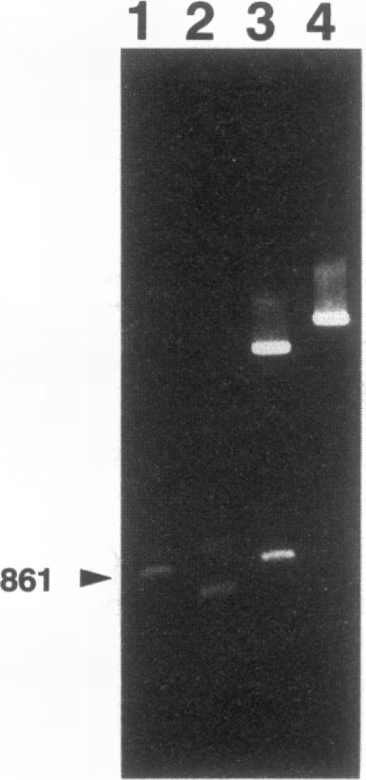 https://cdn.ncbi.nlm.nih.gov/pmc/blobs/188a/205421/0854b5572906/jbacter00027-0294-a.jpg