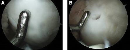 https://cdn.ncbi.nlm.nih.gov/pmc/blobs/1890/5442809/a0f9102a5d76/SCT3-6-613-g001.jpg