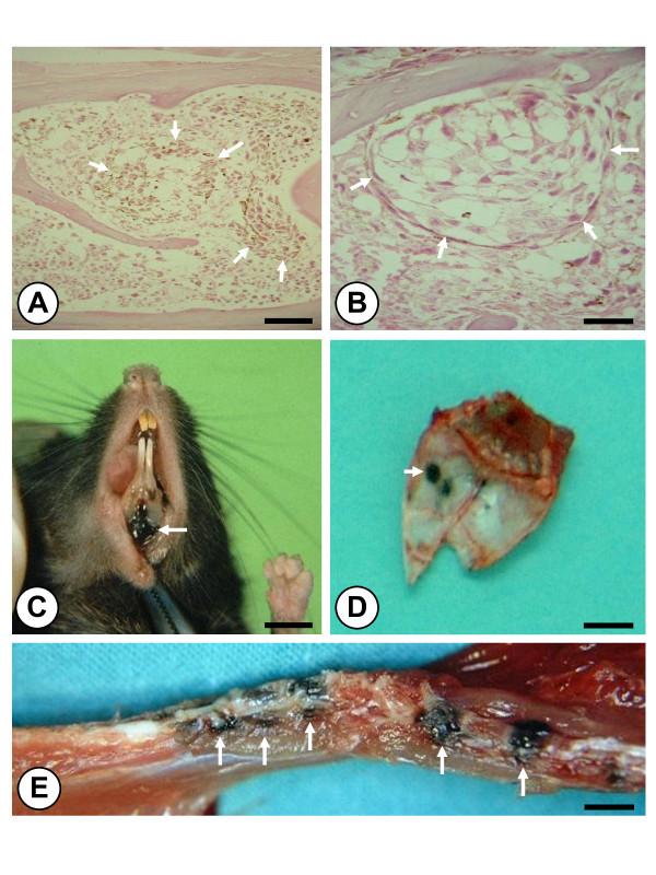 https://cdn.ncbi.nlm.nih.gov/pmc/blobs/1897/3189126/c0e9808f6c3f/1479-5876-9-142-1.jpg