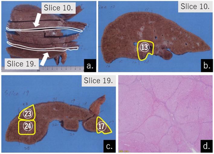 https://cdn.ncbi.nlm.nih.gov/pmc/blobs/1898/6519504/585c708cd5f4/bjrcr.20180066.g004.jpg