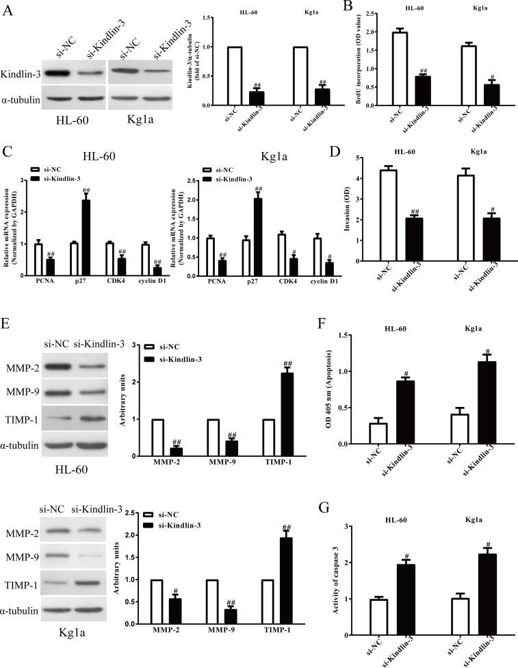 https://cdn.ncbi.nlm.nih.gov/pmc/blobs/1898/7851533/0e296b225590/OR-28-357-g005.jpg