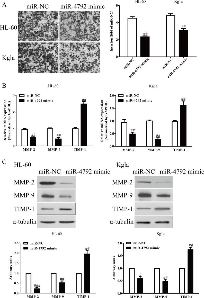 https://cdn.ncbi.nlm.nih.gov/pmc/blobs/1898/7851533/130187584259/OR-28-357-g003.jpg