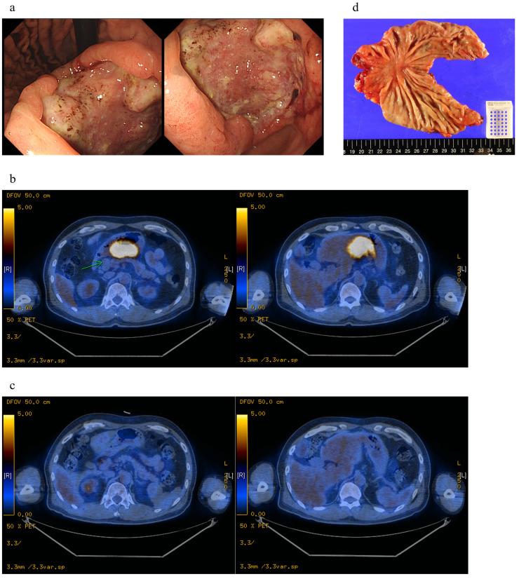 https://cdn.ncbi.nlm.nih.gov/pmc/blobs/1899/10669208/b849ce257c4e/biomedicines-11-03097-g007.jpg