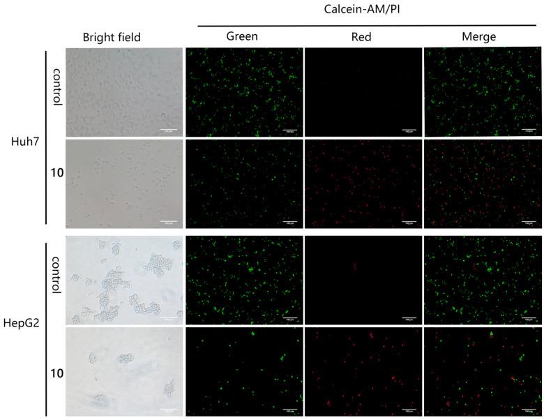 https://cdn.ncbi.nlm.nih.gov/pmc/blobs/18a2/10821474/bf5be0bcd1fc/molecules-29-00393-g003.jpg