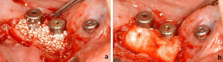 https://cdn.ncbi.nlm.nih.gov/pmc/blobs/18a5/8033620/6132796ad5ab/ASC_55(1)_69-75-f3.jpg