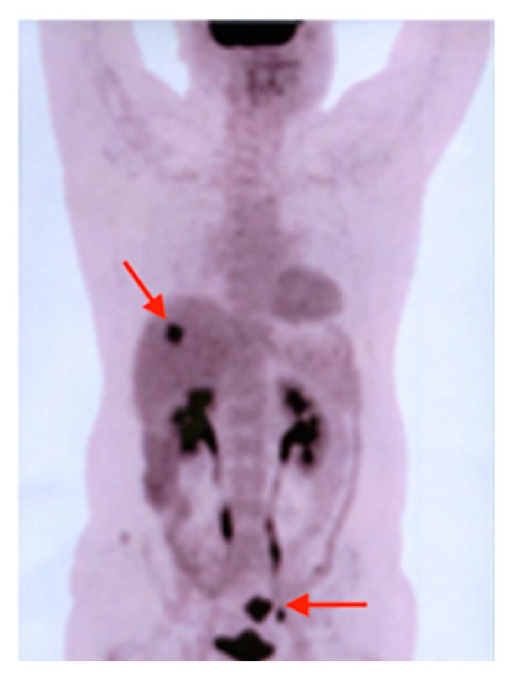 https://cdn.ncbi.nlm.nih.gov/pmc/blobs/18a8/7151349/aec706cd6a02/diagnostics-10-00168-g006.jpg