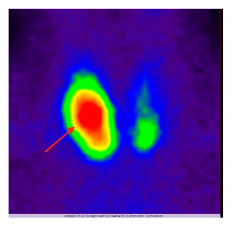https://cdn.ncbi.nlm.nih.gov/pmc/blobs/18a8/7151349/e493954297f1/diagnostics-10-00168-g001.jpg
