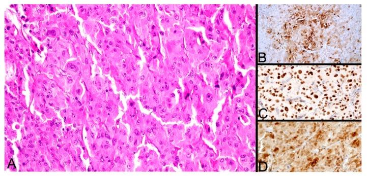 https://cdn.ncbi.nlm.nih.gov/pmc/blobs/18a8/7151349/eac1b4522ea4/diagnostics-10-00168-g003.jpg