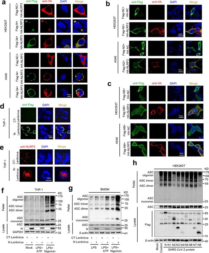 https://cdn.ncbi.nlm.nih.gov/pmc/blobs/18a9/8329225/92c5e6336953/41467_2021_25015_Fig6_HTML.jpg