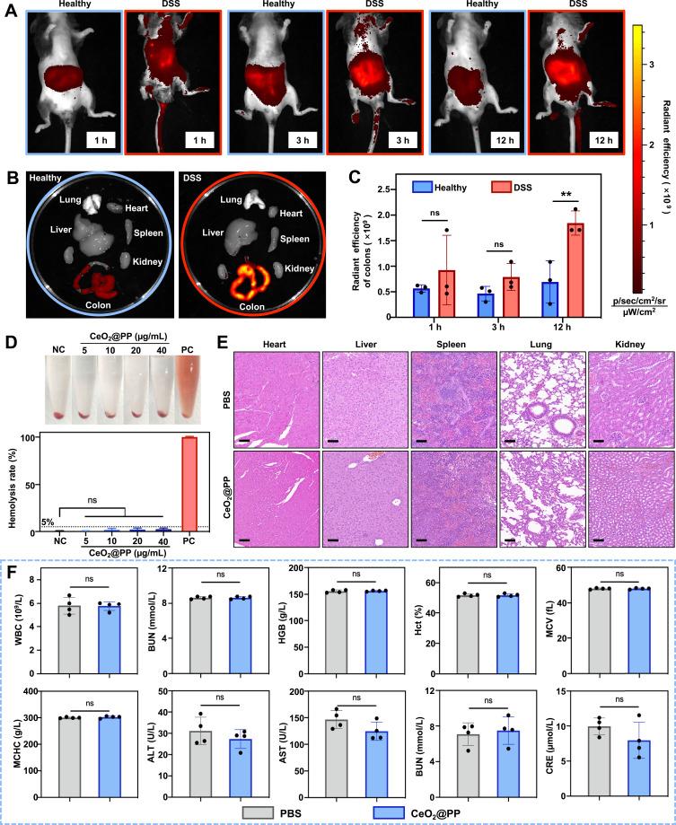 https://cdn.ncbi.nlm.nih.gov/pmc/blobs/18ad/10437713/73a0dbda64af/IJN-18-4601-g0005.jpg