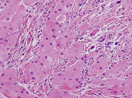 https://cdn.ncbi.nlm.nih.gov/pmc/blobs/18b8/2628063/946279cd6eab/ymj-48-727-g002.jpg