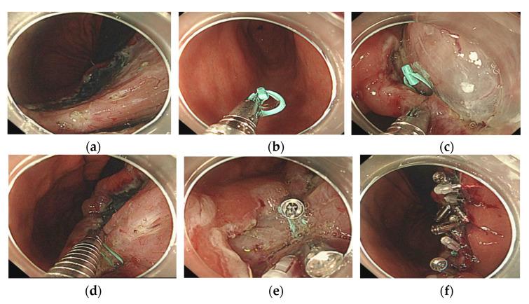 https://cdn.ncbi.nlm.nih.gov/pmc/blobs/18b8/8348124/09461dff023e/jcm-10-03260-g002.jpg