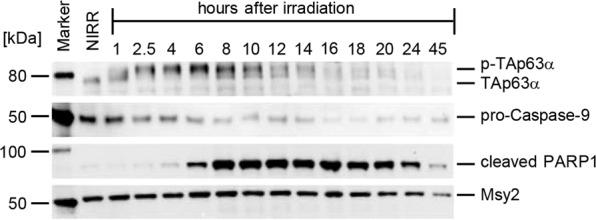 https://cdn.ncbi.nlm.nih.gov/pmc/blobs/18b8/8897389/959a3c9990f3/41419_2022_4659_Fig1_HTML.jpg