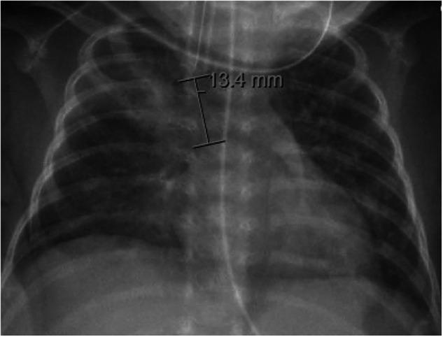 https://cdn.ncbi.nlm.nih.gov/pmc/blobs/18ba/11379627/440829c705fb/41372_2024_1973_Fig2_HTML.jpg