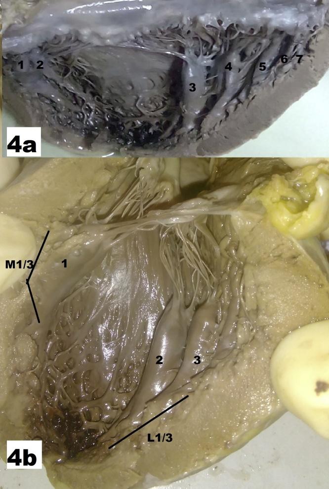 https://cdn.ncbi.nlm.nih.gov/pmc/blobs/18ba/6306352/51bf719bbfda/gr4.jpg