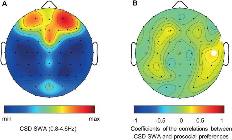 https://cdn.ncbi.nlm.nih.gov/pmc/blobs/18be/11007317/095e0366670e/jneuro-44-e0885232024-g004.jpg