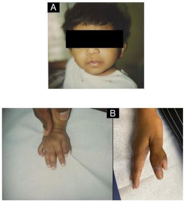 https://cdn.ncbi.nlm.nih.gov/pmc/blobs/18bf/10673431/36be96740fee/medicina-59-01953-g002a.jpg