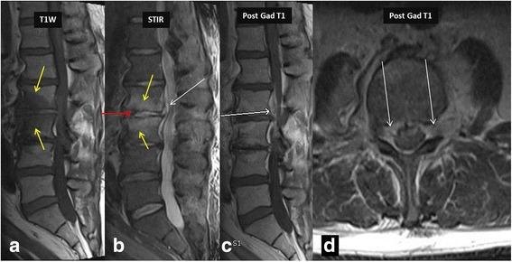 https://cdn.ncbi.nlm.nih.gov/pmc/blobs/18c1/5460517/02e1b4d315ee/12891_2017_1608_Fig2_HTML.jpg