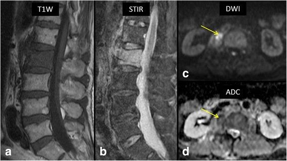 https://cdn.ncbi.nlm.nih.gov/pmc/blobs/18c1/5460517/0ef2bc40345f/12891_2017_1608_Fig5_HTML.jpg