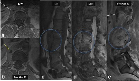 https://cdn.ncbi.nlm.nih.gov/pmc/blobs/18c1/5460517/709bafeb93e1/12891_2017_1608_Fig3_HTML.jpg