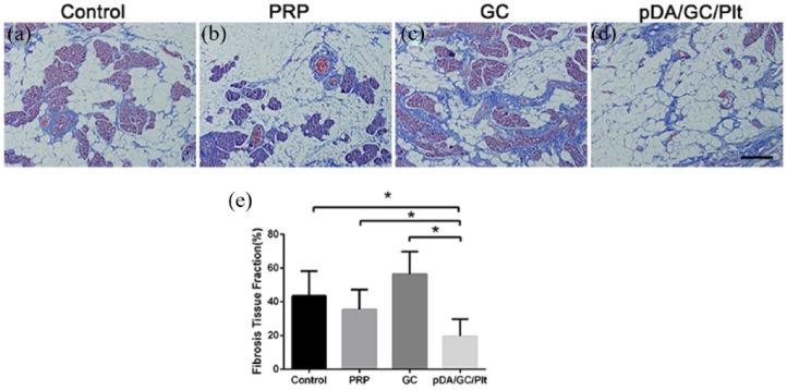 https://cdn.ncbi.nlm.nih.gov/pmc/blobs/18c3/6259050/2617020c0cfa/10.1177_2041731418808633-fig11.jpg