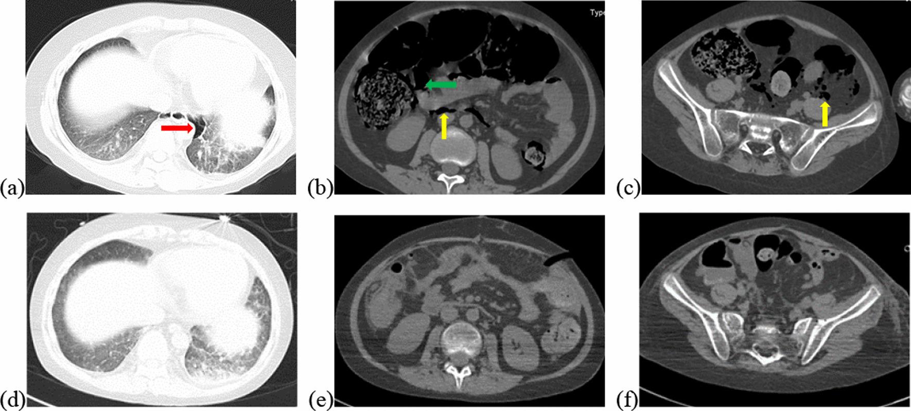 https://cdn.ncbi.nlm.nih.gov/pmc/blobs/18c4/8962223/d39db83ab796/12876_2022_2219_Fig1_HTML.jpg