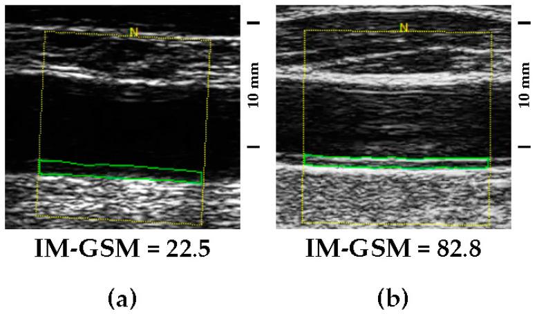 https://cdn.ncbi.nlm.nih.gov/pmc/blobs/18c6/11154292/55fb2789315a/biomedicines-12-00737-g001.jpg