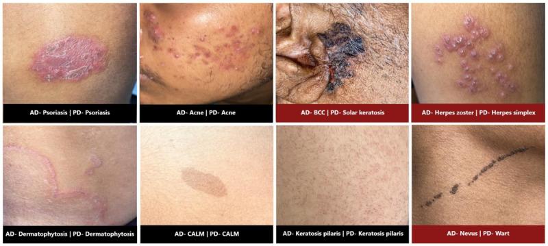 https://cdn.ncbi.nlm.nih.gov/pmc/blobs/18c7/11252620/8dd479e9edd7/derma_v7i1e48811_fig3.jpg