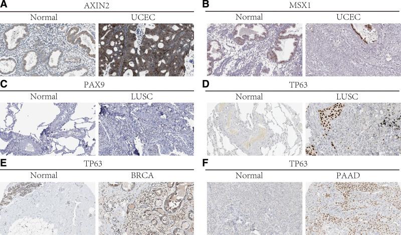 https://cdn.ncbi.nlm.nih.gov/pmc/blobs/18ce/10727548/e51da0fe1230/medi-102-e36001-g006.jpg