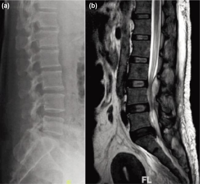 https://cdn.ncbi.nlm.nih.gov/pmc/blobs/18d0/5630060/e29264e30ccc/moj-11-085-f1.jpg